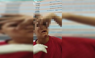 Adolescente autista que teve os dentes quebrados precisa de implante