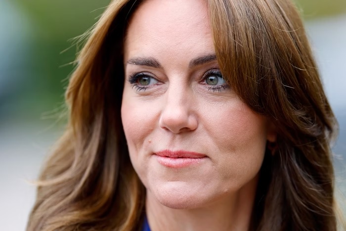 Kate contraria a família real e se recusa a usar peruca, diz jornal