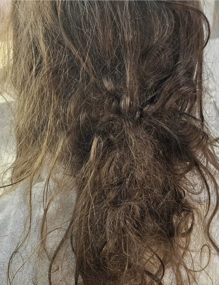 Adolescente sobrevive a grave afogamento após cabelo prender em ralo de piscina no RN | Foto: Reprodução/Instagram