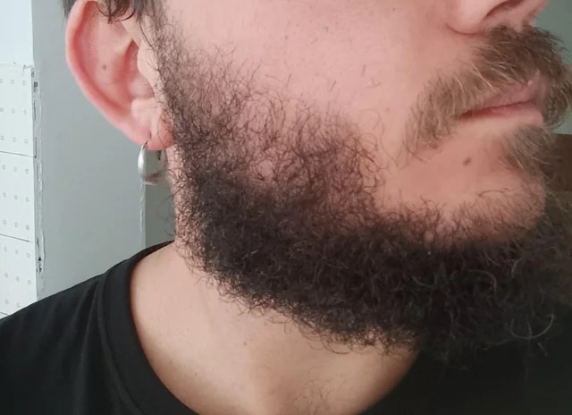 Barba | Foto: Reprodução/Reddit