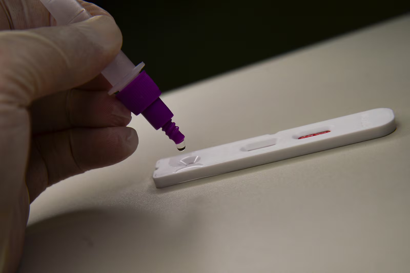 Vírus identificado é diferente do H5N1, que costuma atingir humanos Marcello Casal Jr/Agência Brasil