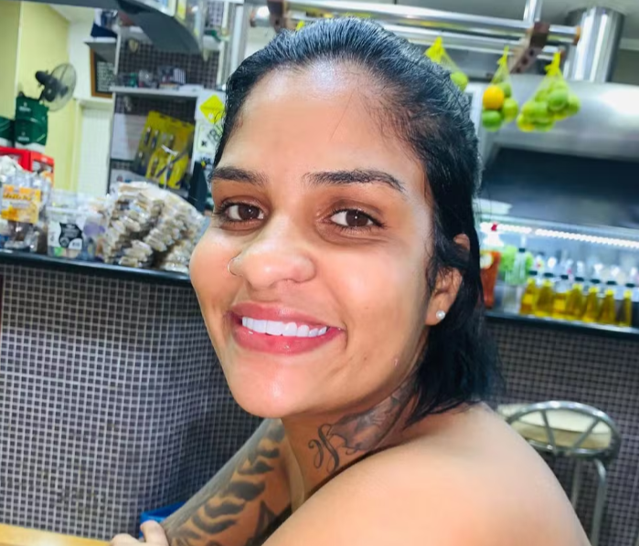 FireShot Capture 636 - Mulher que teve pernas amputadas em SP irá passar por nova cirurgia_ - [g1.globo.com].png