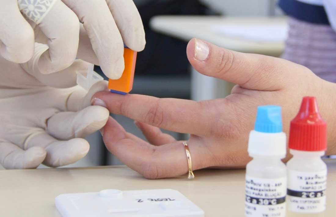testes-hiv-gov-sp.jpg