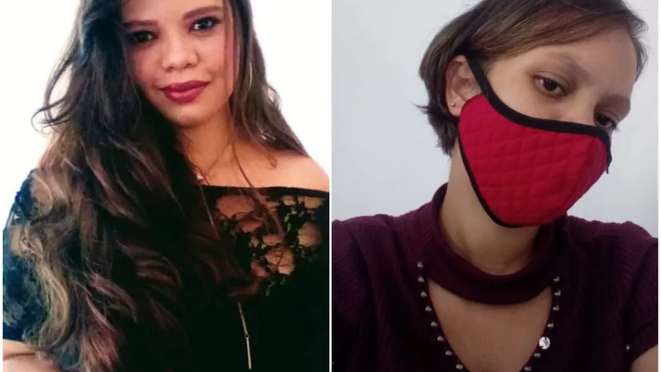 Jovem mostra ‘antes e depois’ de ser agredida e ter cabelo cortado por namorado que conheceu na internet