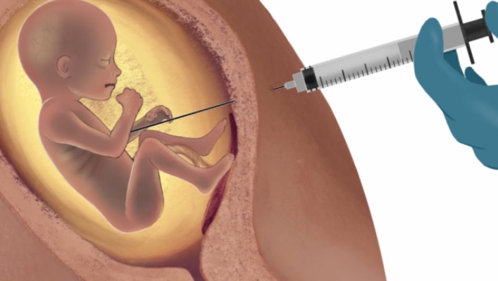 Ministério da Saúde inclui legalização do aborto e da maconha entre planos dos próximos 4 anos