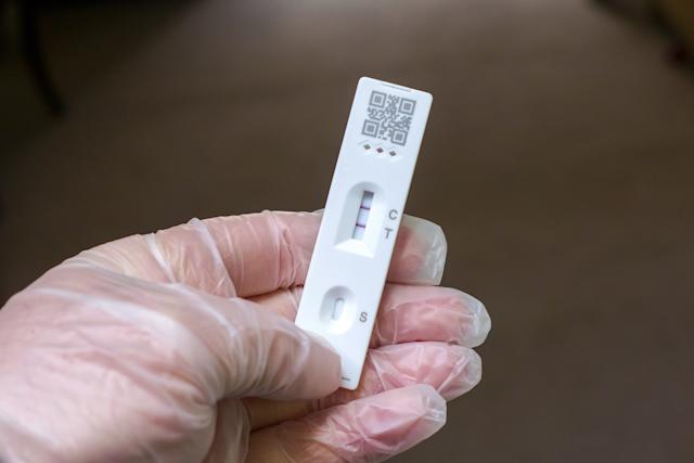 Testes para gripe estão começando a faltar