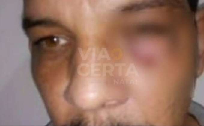 Passageiro se recusa a colocar cinto e agride motorista de aplicativo na Grande Natal