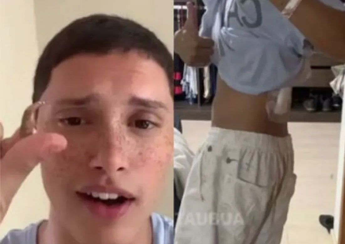 'Acordei e tinha uma bala nas minhas costas', diz jovem baleado dentro de casa enquanto dormia