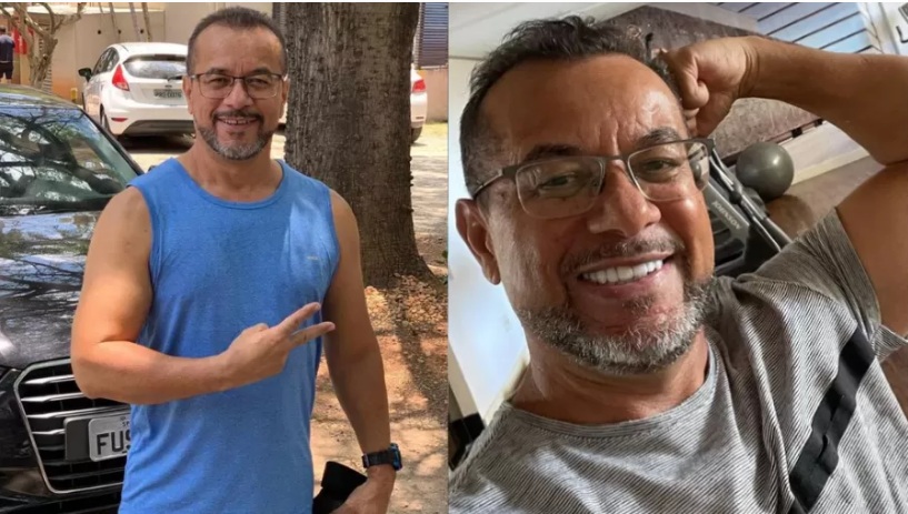 Homem morre após fazer implante para colocar facetas dentárias, diz marido