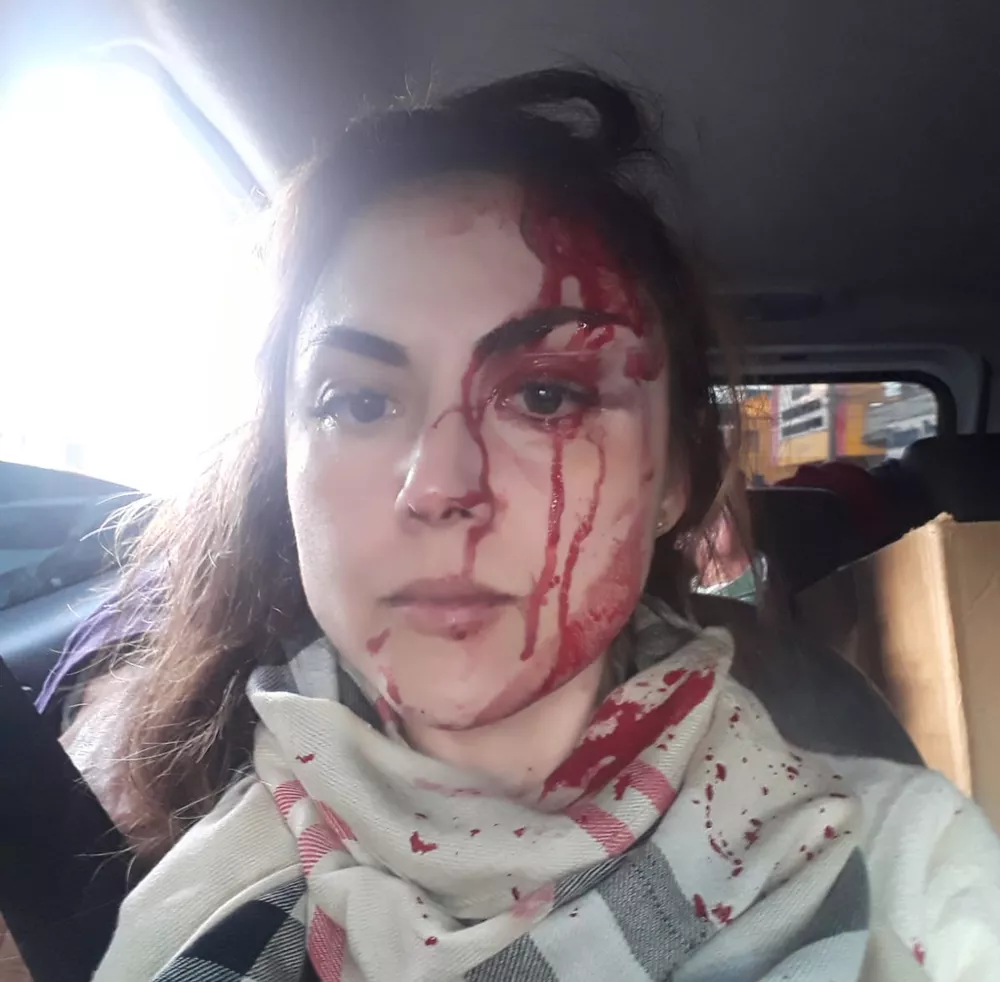 [VIDEO] Procuradora é brutalmente agredida por colega após abertura de processo disciplinar