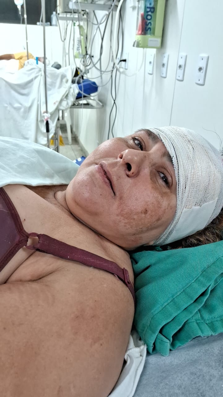 Mulher sobrevive após sofrer tiro na cabeça pelo o ex-companheiro na Grande Natal