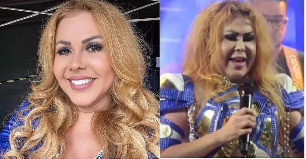 Especialista explica novo quadro de saúde da cantora Joelma, que segue internada