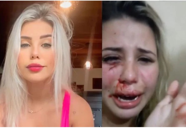 Influencer é espancada e pede socorro nas redes : “Me ajuda, por favor!”