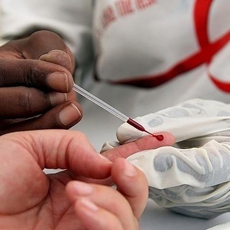 Casos de Aids aumentam quase 40% e RN registra mais de 6 mil pessoas com a doença em 10 anos;...