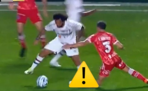 [IMAGEM FORTE] Jogador argentino quebra perna após sofrer pisão de Marcelo e imagem choca web