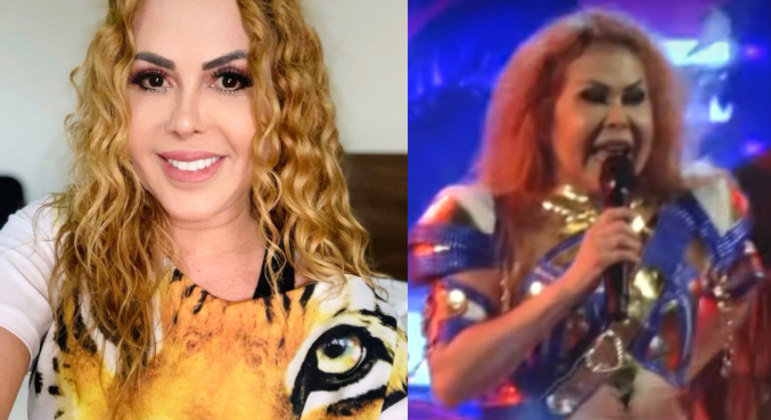 Joelma recebe alta e deixa o hospital; Veja antes e depois da cantora